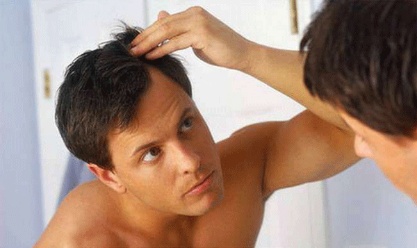 man-with-thinning-hair
